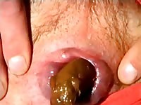 MILF's hairy asshole shits on camera