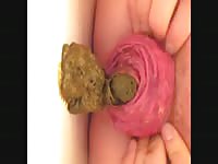 Poop coming out of a whore